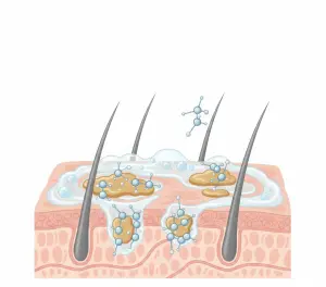 процесс очищения кожи