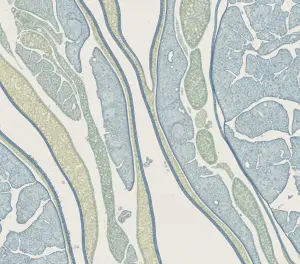 Макросъемка почечных структур