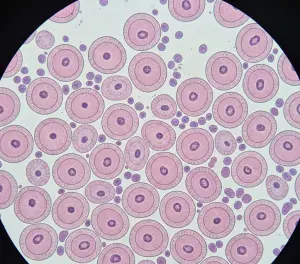 Микроскопическое строение фолликулов щитовидной железы